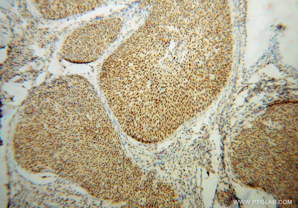 HNRNPH1 IHC Immunohistochemical 14774-1-AP HNRNPH1 Antibody DKFZp686A15170; HNRPH; HNRPH1; hnRNPH