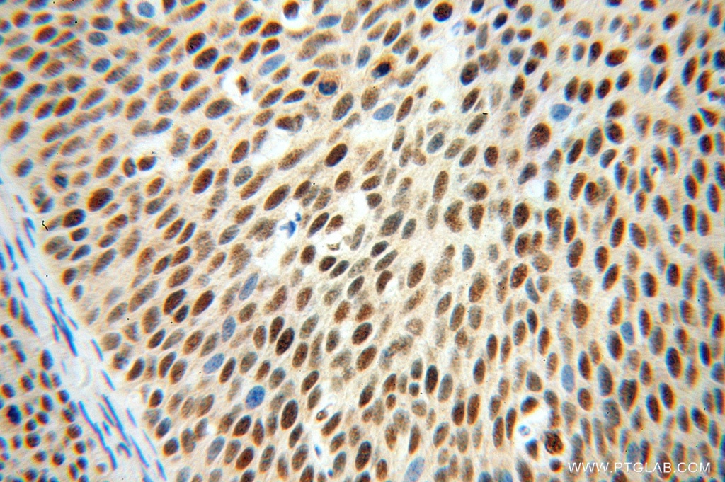 HNRNPH1 IHC Immunohistochemical 14774-1-AP HNRNPH1 Antibody DKFZp686A15170; HNRPH; HNRPH1; hnRNPH