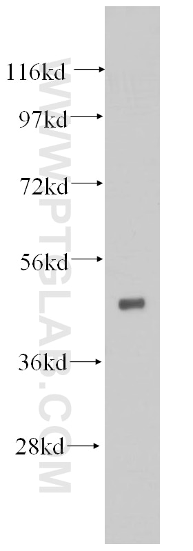 HNRNPH1 western blot WB 14774-1-AP HNRNPH1 Antibody DKFZp686A15170; HNRPH; HNRPH1; hnRNPH