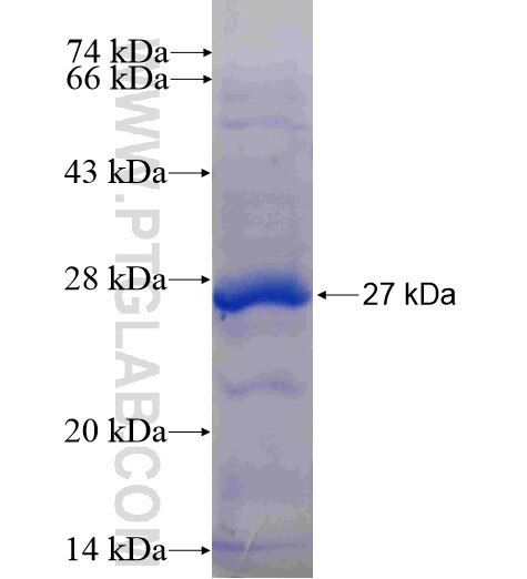 HSD17B7P2 fusion protein ag10315 SDS-PAGE