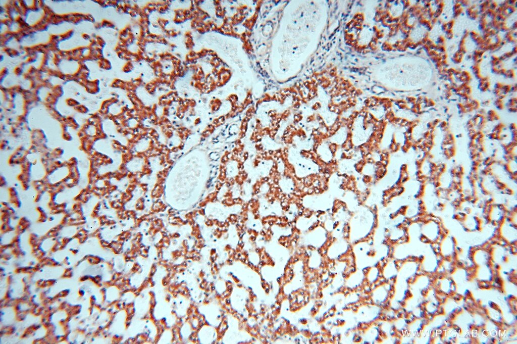 HSD17B8 IHC Immunohistochemical 16752-1-AP HSD17B8 Antibody D6S2245E; FABG; FABGL; H2-KE6; HKE6; KE6; RING2; SDR30C1; dJ1033B10.9