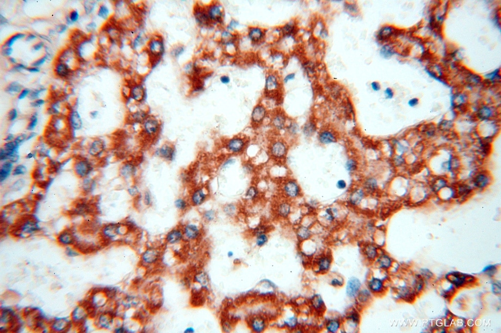 HSD17B8 IHC Immunohistochemical 16752-1-AP HSD17B8 Antibody D6S2245E; FABG; FABGL; H2-KE6; HKE6; KE6; RING2; SDR30C1; dJ1033B10.9