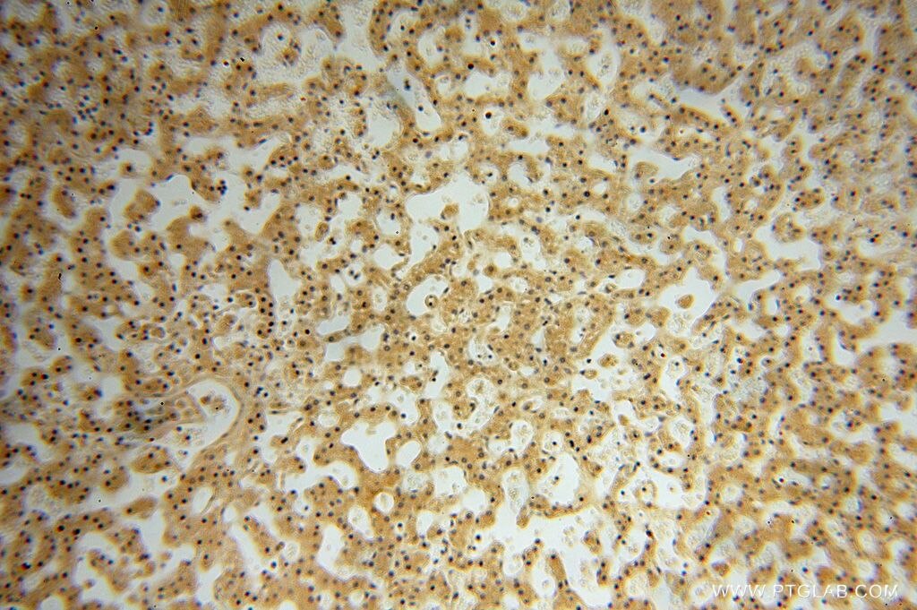 HSDL1 IHC Immunohistochemical 16988-1-AP HSDL1 Antibody MGC125994; MGC125995; MGC126032; SDR12C3