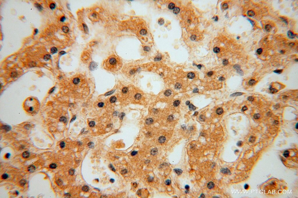 HSDL1 IHC Immunohistochemical 16988-1-AP HSDL1 Antibody MGC125994; MGC125995; MGC126032; SDR12C3