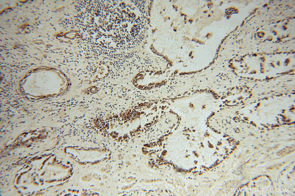 HSDL2 IHC Immunohistochemical 15631-1-AP HSDL2 Antibody C9orf99; FLJ25855; MGC10940; SDR13C1