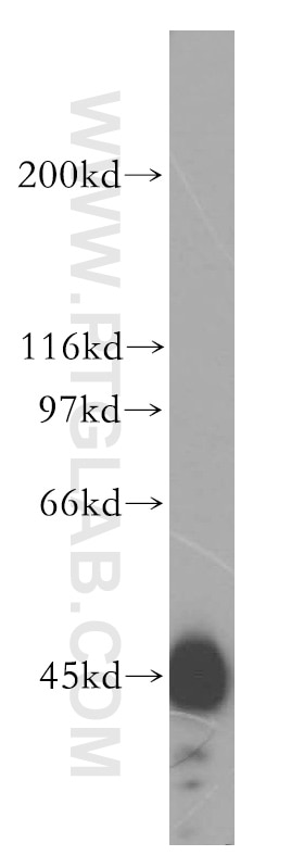 HSDL2 western blot WB 15631-1-AP HSDL2 Antibody C9orf99; FLJ25855; MGC10940; SDR13C1