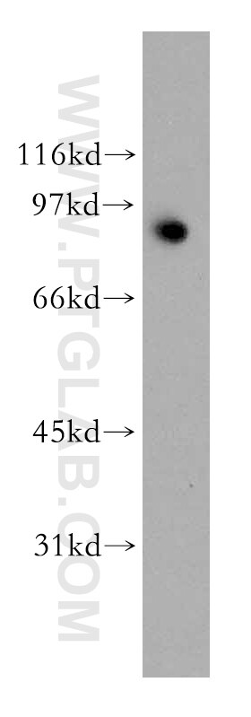 Y79 cells were subjected to SDS PAGE followed by western blot with 13171-1-AP(HSP90 Antibody) at dilution of 1:1000 HSP90 western blot WB 13171-1-AP HSP90 Antibody FLJ31884; HSP86; HSP89A; HSP90A; HSP90N; HSPC1; HSPCA; HSPCAL1; HSPCAL4; HSPN; Hsp89; Hsp90; LAP2