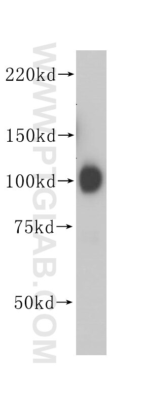 HSP90B1 western blot WB 14700-1-AP HSP90B1 Antibody ECGP; GP96; GRP94; TRA1
