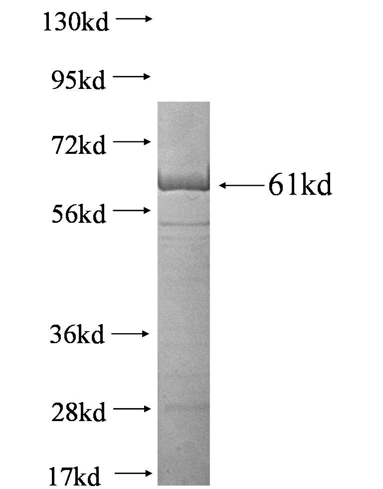 HSP90B1 fusion protein ag1439 SDS-PAGE