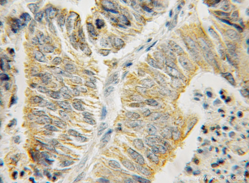 HSPA13 IHC Immunohistochemical 12667-2-AP HSPA13 Antibody STCH