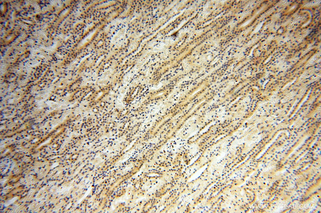 IDH1 IHC Immunohistochemical 12332-1-AP IDH1 Antibody IDCD; IDH; IDP; IDPC; PICD