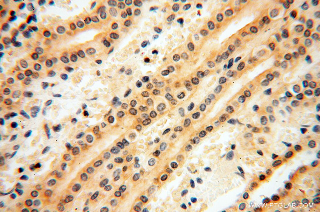 IDH1 IHC Immunohistochemical 12332-1-AP IDH1 Antibody IDCD; IDH; IDP; IDPC; PICD