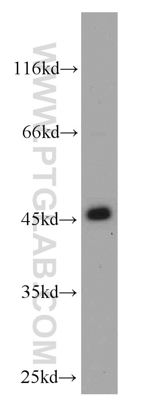 IDH1 western blot WB 12332-1-AP IDH1 Antibody IDCD; IDH; IDP; IDPC; PICD