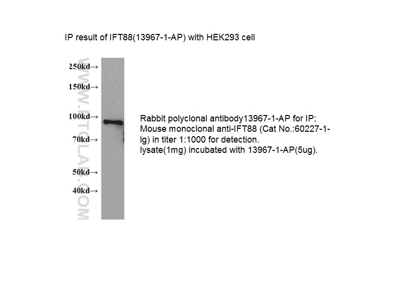 IFT88 IP 13967-1-AP IFT88 Antibody D13S1056E; DAF19; MGC26259; RP11-172H24.2; TG737; TTC10; hTg737