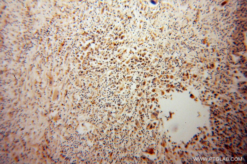 IFT88 IHC Immunohistochemical 13967-1-AP IFT88 Antibody D13S1056E; DAF19; MGC26259; RP11-172H24.2; TG737; TTC10; hTg737