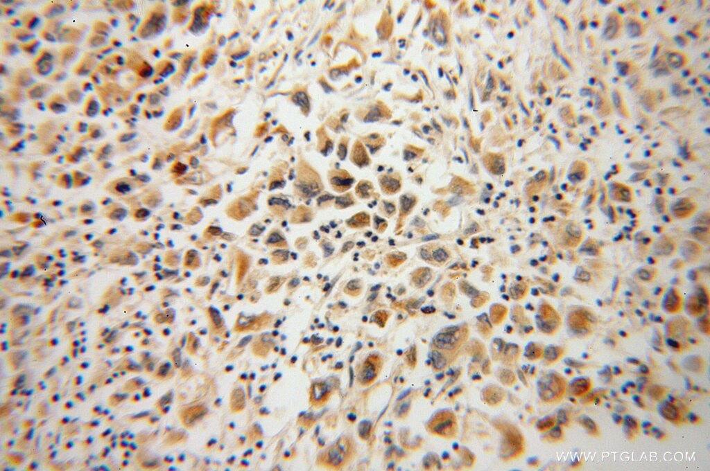 IFT88 IHC Immunohistochemical 13967-1-AP IFT88 Antibody D13S1056E; DAF19; MGC26259; RP11-172H24.2; TG737; TTC10; hTg737