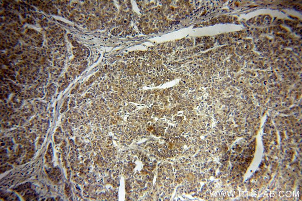 IGF1A-Specific IHC Immunohistochemical 20214-1-AP IGF1A-Specific Antibody IGF1A; IGFI