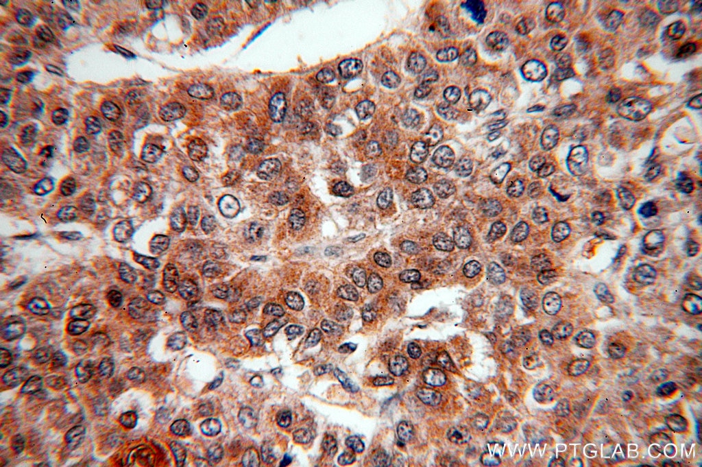 IGF1A-Specific IHC Immunohistochemical 20214-1-AP IGF1A-Specific Antibody IGF1A; IGFI