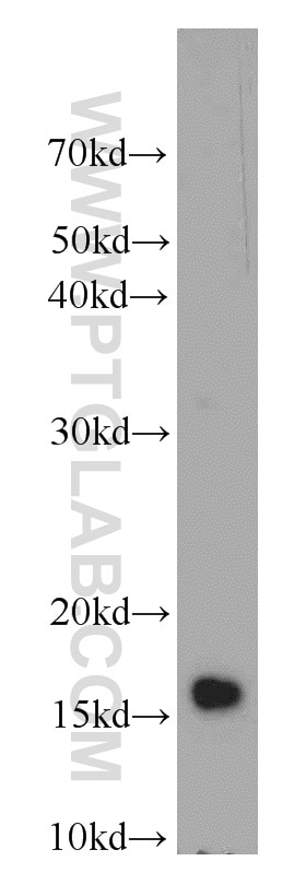 IGF1A-Specific western blot WB 20214-1-AP IGF1A-Specific Antibody IGF1A; IGFI