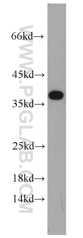 HeLa cells were subjected to SDS PAGE followed by western blot with 10189-2-AP(IGFBP3 Antibody) at dilution of 1:300 IGFBP3 western blot WB 10189-2-AP IGFBP3 Antibody BP-53; IBP3