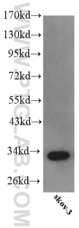 IGFBP5 western blot WB 55205-1-AP IGFBP5 Antibody IBP5
