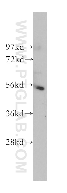 IKZF1 western blot WB 12016-1-AP IKZF1 Antibody Hs.54452; IK1; IKAROS; LYF1; PRO0758; ZNFN1A1; hIk-1