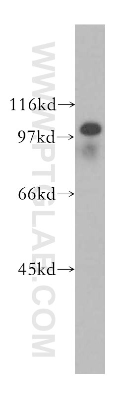 K-562 cells were subjected to SDS PAGE followed by western blot with 13287-1-AP(IL12RB1 Antibody) at dilution of 1:1000 IL12RB1 western blot WB 13287-1-AP IL12RB1 Antibody CD212; IL-12R-BETA1; IL12RB; MGC34454