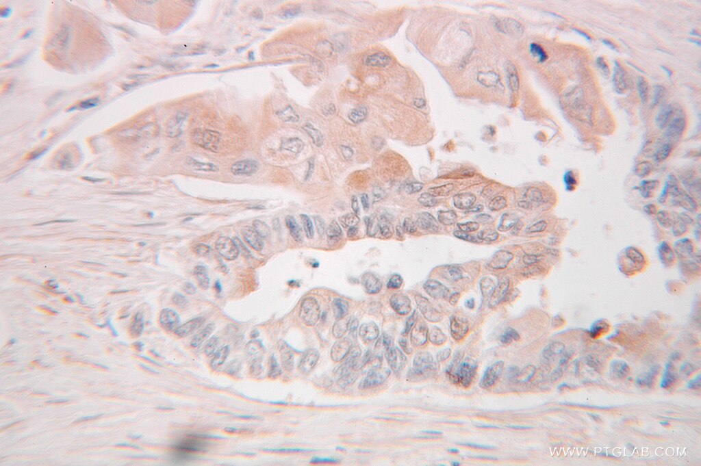 Pre-IL18 IHC Immunohistochemical 10663-1-AP Pre-IL18 Antibody IGIF; IL-18; IL-1g; IL1F4; MGC12320