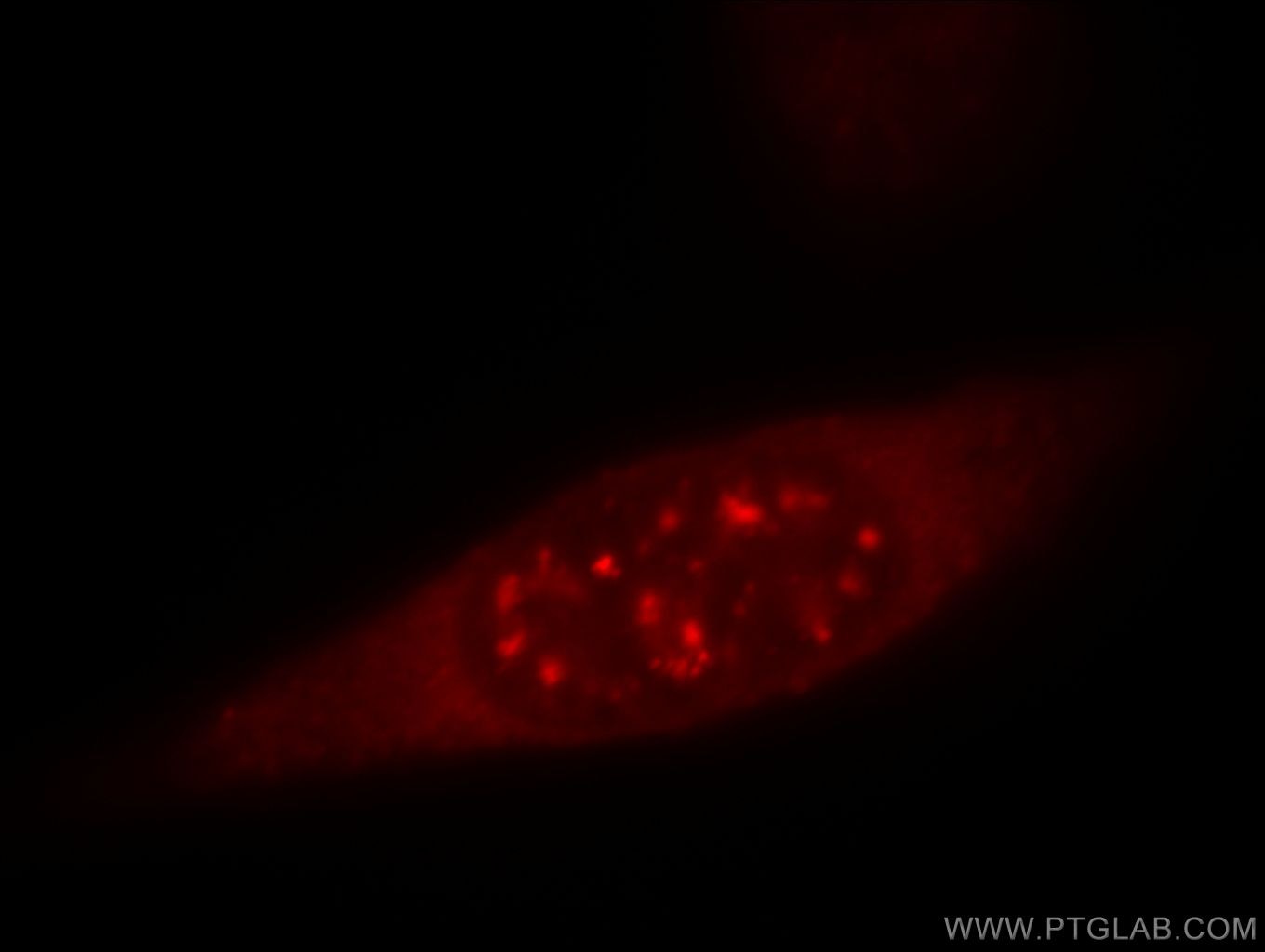 Immunofluorescent analysis of MCF-7 cells, using IL18 antibody 60070-1-lg at 1:25 dilution and Rhodamine-labeled goat anti-mouse IgG (red). Pre-IL18 Immunofluorescence IF 60070-1-Ig Pre-IL18 Antibody IGIF; IL-18; IL-1g; IL1F4; MGC12320