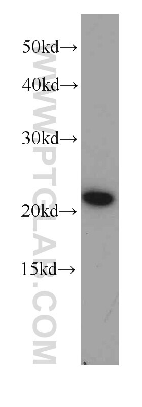Hela cells were subjected to SDS PAGE followed by western blot with 60070-1-Ig(Pre-IL18 Antibody) at dilution of 1:1000 Pre-IL18 western blot WB 60070-1-Ig Pre-IL18 Antibody IGIF; IL-18; IL-1g; IL1F4; MGC12320