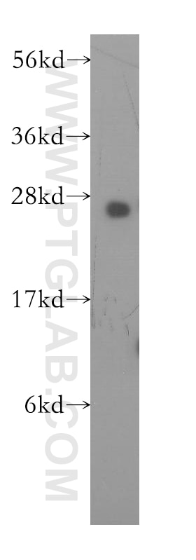 human brain tissue were subjected to SDS PAGE followed by western blot with 11863-1-AP(IL1F7 Antibody) at dilution of 1:800 IL1F7 western blot WB 11863-1-AP IL1F7 Antibody FIL1; FIL1(ZETA); FIL1Z; IL-1F7; IL-1H4; IL-1RP1; IL1H4; IL1RP1