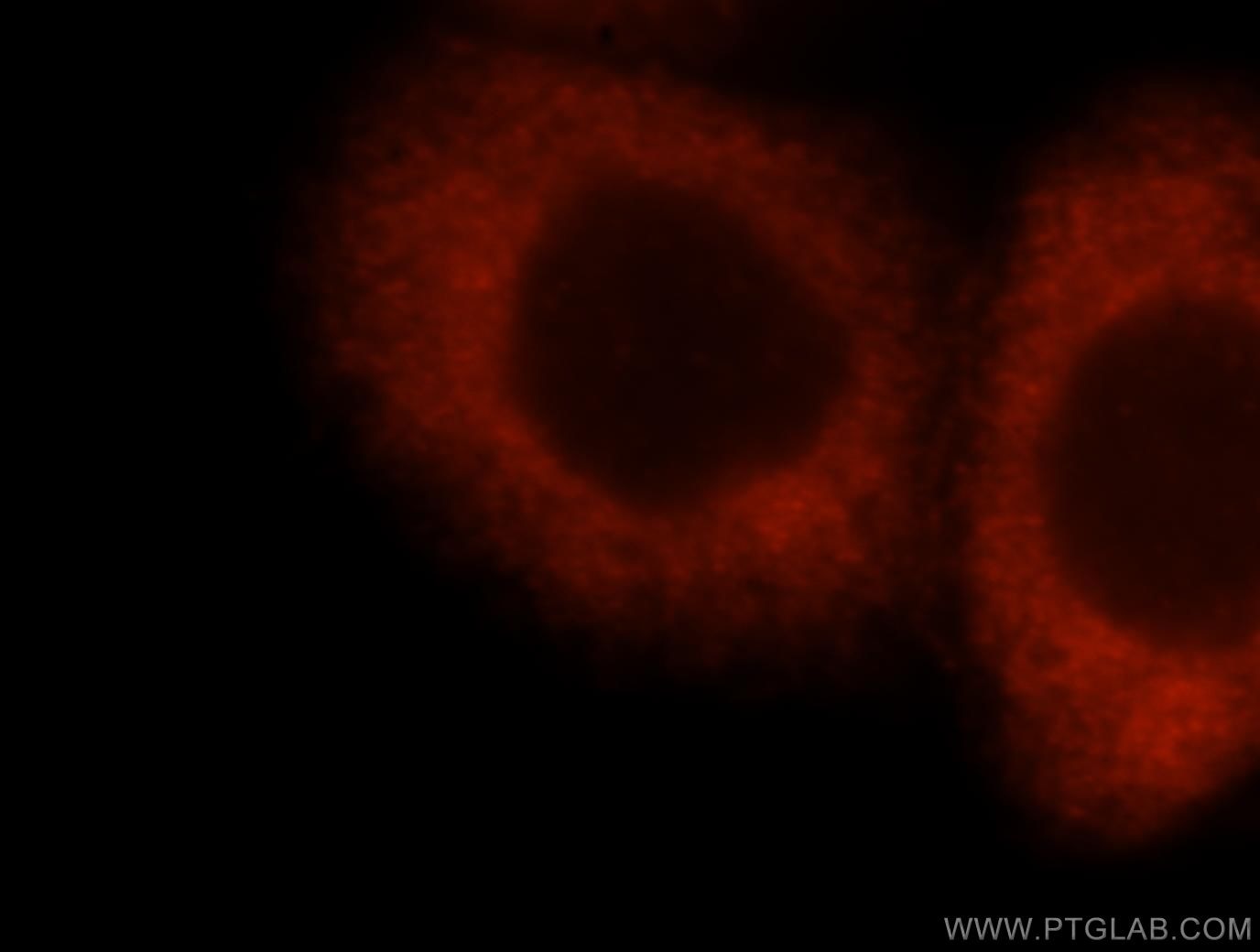 IMPDH2 Immunofluorescence IF 12948-1-AP IMPDH2 Antibody IMPD2; IMPDH-II