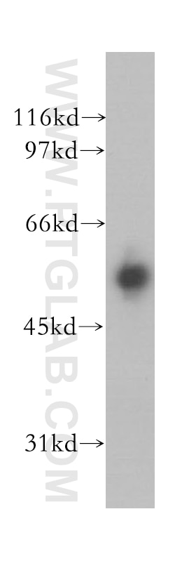 IMPDH2 western blot WB 12948-1-AP IMPDH2 Antibody IMPD2; IMPDH-II
