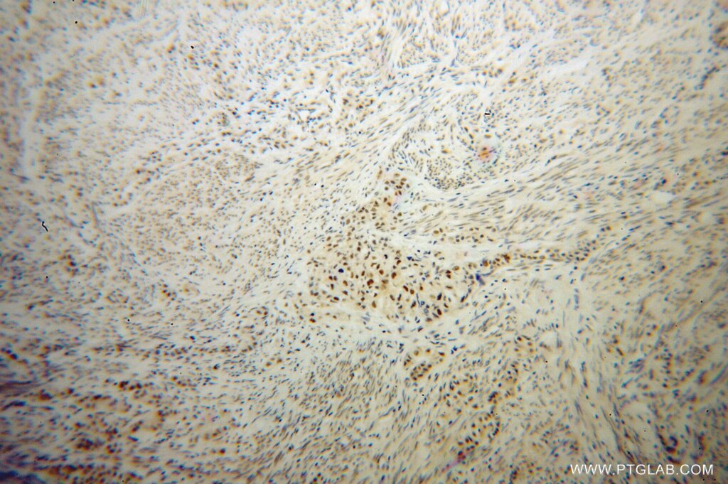 IRF2BP1 IHC Immunohistochemical 13698-1-AP IRF2BP1 Antibody DKFZp434M154