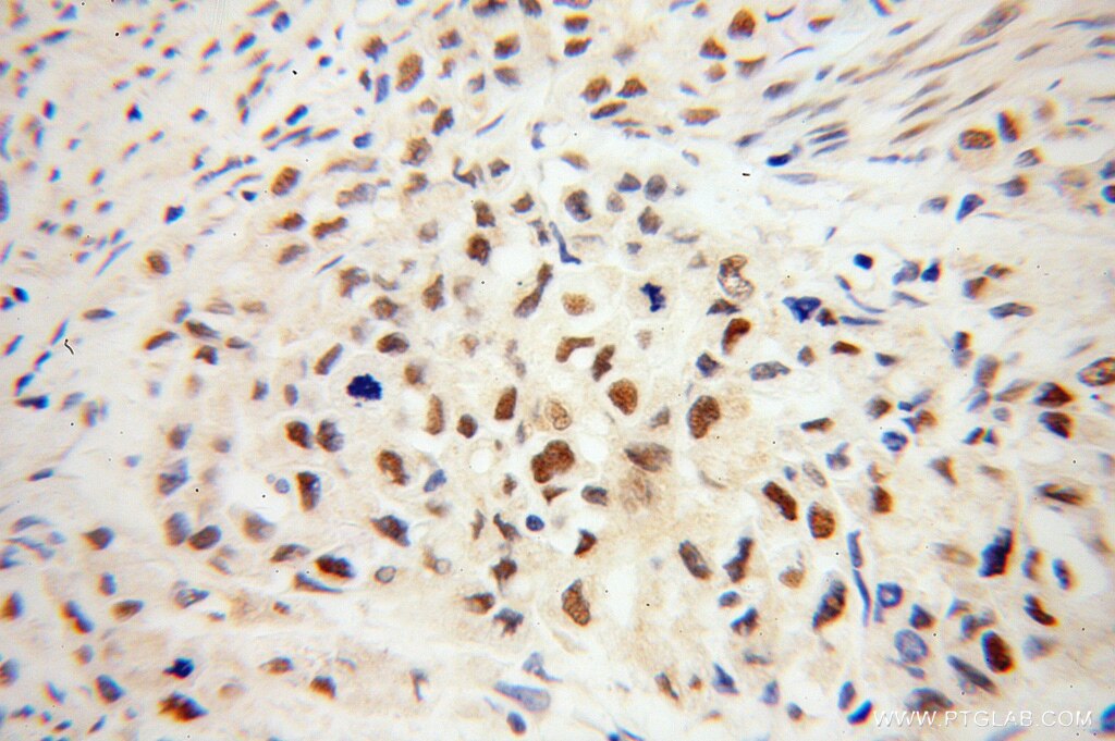 IRF2BP1 IHC Immunohistochemical 13698-1-AP IRF2BP1 Antibody DKFZp434M154