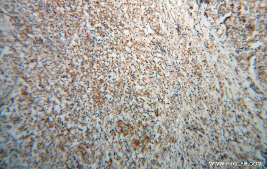 IRF5 IHC Immunohistochemical 10547-1-AP IRF5 Antibody SLEB10
