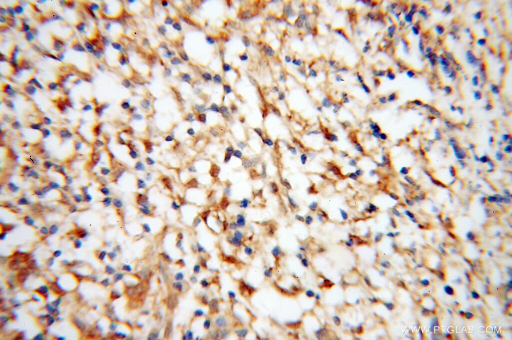 IRF5 IHC Immunohistochemical 10547-1-AP IRF5 Antibody SLEB10