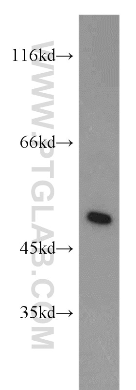 IRF5 western blot WB 10547-1-AP IRF5 Antibody SLEB10