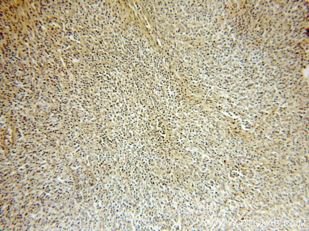 IRF8 IHC Immunohistochemical 18977-1-AP IRF8 Antibody H-ICSBP; ICSBP; ICSBP1; IRF-8