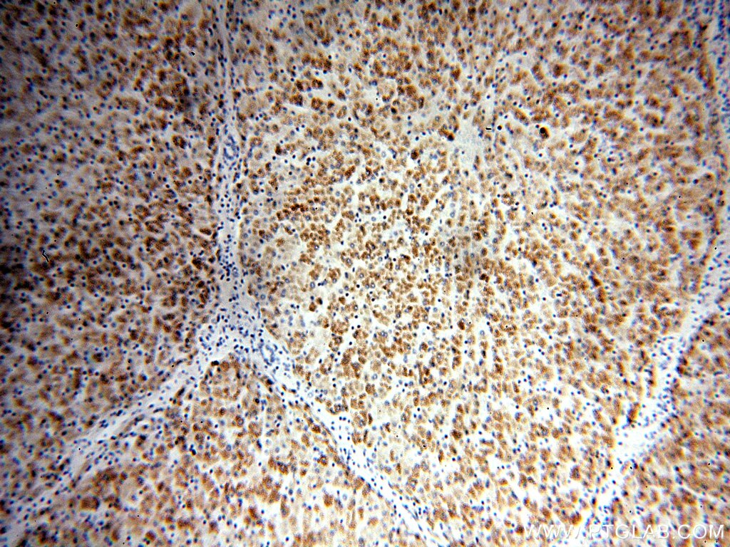 IVD IHC Immunohistochemical 10822-1-AP IVD Antibody ACAD2