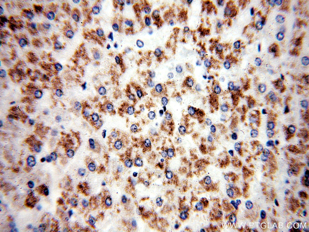 IVD IHC Immunohistochemical 10822-1-AP IVD Antibody ACAD2