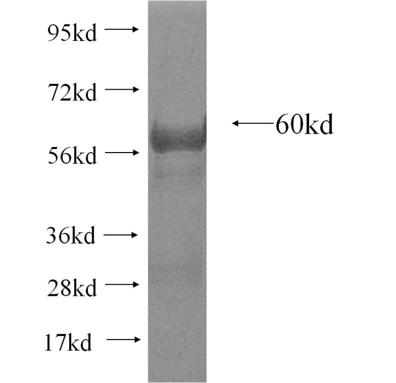 JAG1 fusion protein ag11891 SDS-PAGE