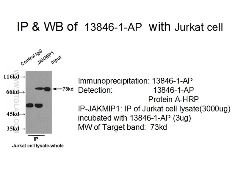 JAKMIP1 IP 13846-1-AP JAKMIP1 Antibody FLJ31564; Gababrbp; JAMIP1; MARLIN1