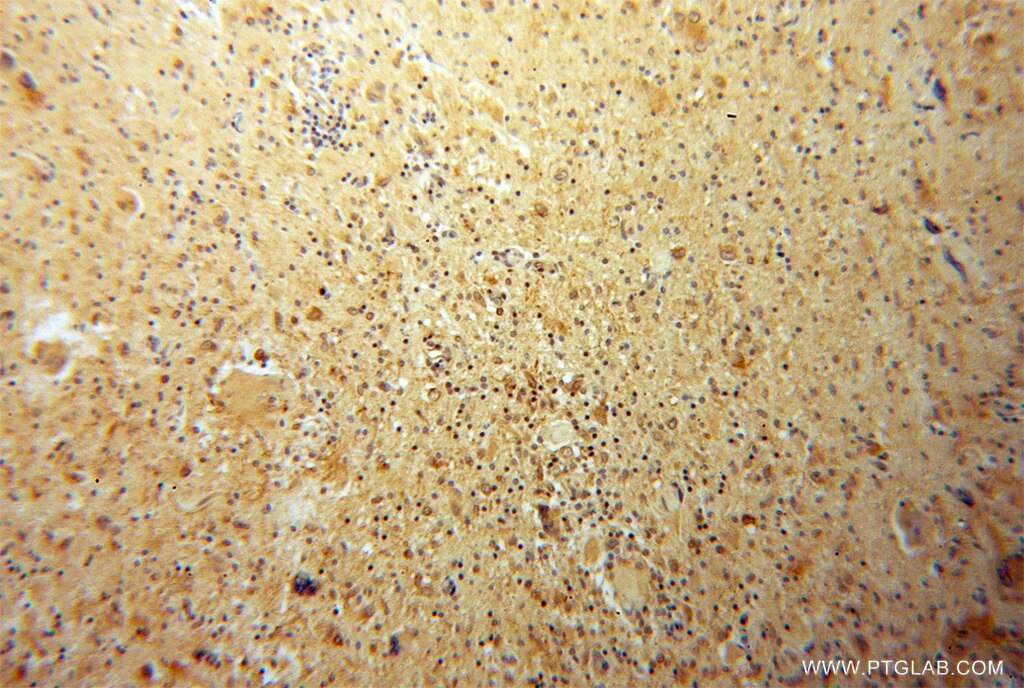 JAKMIP1 IHC Immunohistochemical 13846-1-AP JAKMIP1 Antibody FLJ31564; Gababrbp; JAMIP1; MARLIN1