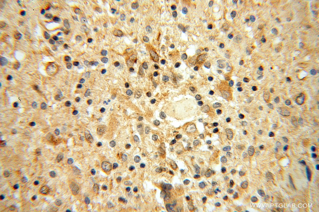 JAKMIP1 IHC Immunohistochemical 13846-1-AP JAKMIP1 Antibody FLJ31564; Gababrbp; JAMIP1; MARLIN1