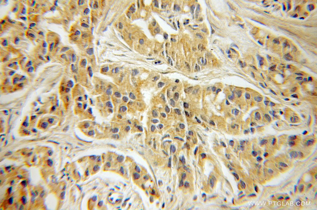JUB IHC Immunohistochemical 10653-1-AP JUB Antibody Ajuba; MGC15563