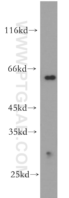 mouse brain tissue were subjected to SDS PAGE followed by western blot with 17560-1-AP(KATNA1 Antibody) at dilution of 1:800 KATNA1 western blot WB 17560-1-AP KATNA1 Antibody