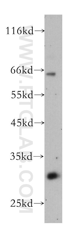 Human brain were subjected to SDS PAGE followed by western blot with 60133-1-Ig(KCNIP4 Antibody) at dilution of 1:300 KCNIP4 western blot WB 60133-1-Ig KCNIP4 Antibody CALP; KCHIP4; MGC44947