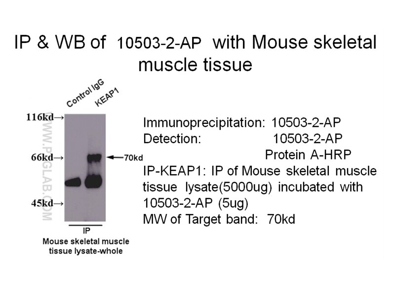 KEAP1 IP 10503-2-AP KEAP1 Antibody INrf2; KIAA0132; KLHL19; MGC10630; MGC1114; MGC20887; MGC4407; MGC9454
