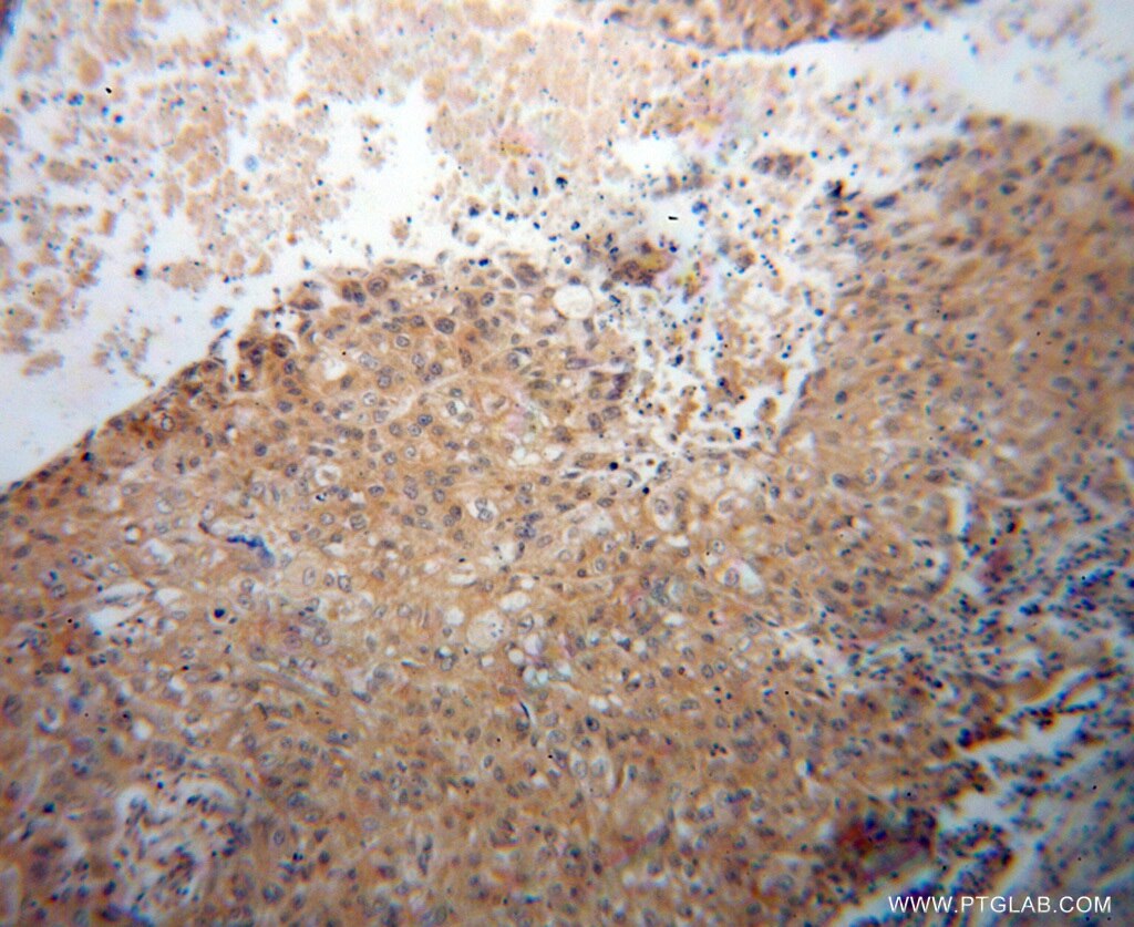 KEAP1 IHC Immunohistochemical 10503-2-AP KEAP1 Antibody INrf2; KIAA0132; KLHL19; MGC10630; MGC1114; MGC20887; MGC4407; MGC9454